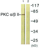 Anti-PKC &#945; antibody produced in rabbit affinity isolated antibody