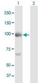 Anti-BAP1 antibody produced in mouse purified immunoglobulin, buffered aqueous solution