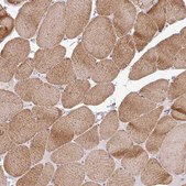 Anti-HBEGF antibody produced in rabbit Prestige Antibodies&#174; Powered by Atlas Antibodies, affinity isolated antibody, buffered aqueous glycerol solution