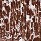 Anti-NDUFS2 antibody produced in rabbit Prestige Antibodies&#174; Powered by Atlas Antibodies, affinity isolated antibody, buffered aqueous glycerol solution