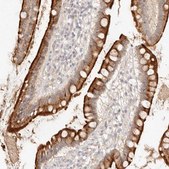 Anti-MEP1A antibody produced in rabbit Prestige Antibodies&#174; Powered by Atlas Antibodies, affinity isolated antibody, buffered aqueous glycerol solution
