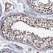 Anti-TRMT112 antibody produced in rabbit Prestige Antibodies&#174; Powered by Atlas Antibodies, affinity isolated antibody, buffered aqueous glycerol solution
