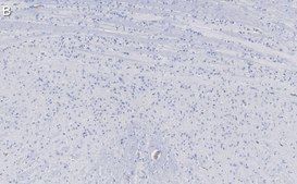 Anti-Calretinin Antibody, clone 6B8.2 ZooMAb&#174; Mouse Monoclonal recombinant, expressed in HEK 293 cells