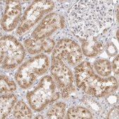 Anti-FDPS antibody produced in rabbit Prestige Antibodies&#174; Powered by Atlas Antibodies, affinity isolated antibody, buffered aqueous glycerol solution