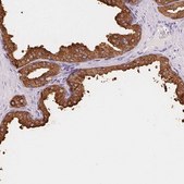 Anti-ACPP antibody produced in rabbit Prestige Antibodies&#174; Powered by Atlas Antibodies, affinity isolated antibody, buffered aqueous glycerol solution