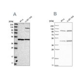 Anti-NUP43 antibody produced in rabbit Prestige Antibodies&#174; Powered by Atlas Antibodies, affinity isolated antibody, buffered aqueous glycerol solution, ab1