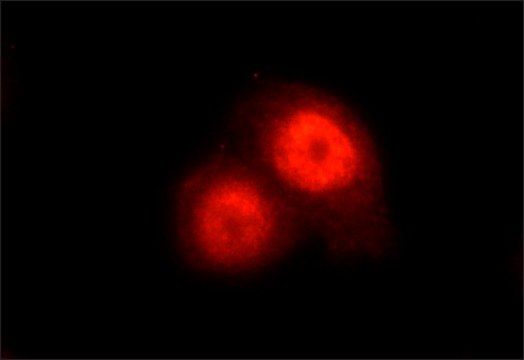 Anti-KLF5 antibody , Mouse monoclonal clone KLF5-55, purified from hybridoma cell culture