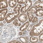 Anti-USP2 antibody produced in rabbit Prestige Antibodies&#174; Powered by Atlas Antibodies, affinity isolated antibody, buffered aqueous glycerol solution