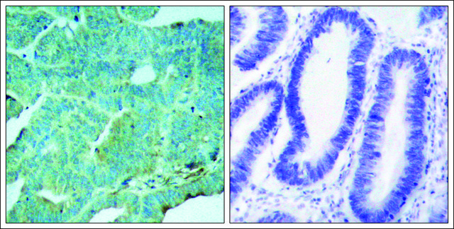 Anti-phospho-EIF2AK2 (pThr446) antibody produced in rabbit affinity isolated antibody