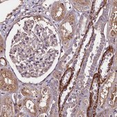 Anti-PALM antibody produced in rabbit Prestige Antibodies&#174; Powered by Atlas Antibodies, affinity isolated antibody, buffered aqueous glycerol solution