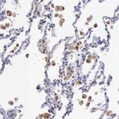 Anti-TYMP antibody produced in rabbit Prestige Antibodies&#174; Powered by Atlas Antibodies, affinity isolated antibody, buffered aqueous glycerol solution