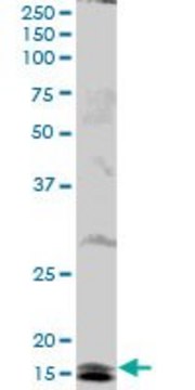 Anti-UBE2B antibody produced in mouse purified immunoglobulin, buffered aqueous solution