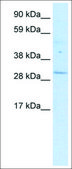 Anti-POU6F1 (AB1) antibody produced in rabbit affinity isolated antibody