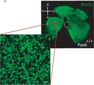 Anticorps anti-Brn-3a (protéine à domaine POU), clone 5A3.2 culture supernatant, clone 5A3.2, Chemicon&#174;