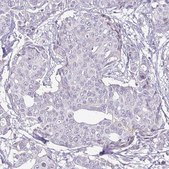 Monoclonal Anti-HER2 antibody produced in mouse Prestige Antibodies&#174; Powered by Atlas Antibodies, clone CL0268, purified immunoglobulin, buffered aqueous glycerol solution
