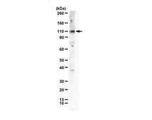 Anti-Anoctamin-1 (TMEM16A) from rabbit