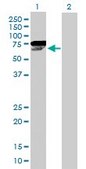 Anti-CHEK2 antibody produced in mouse purified immunoglobulin, buffered aqueous solution