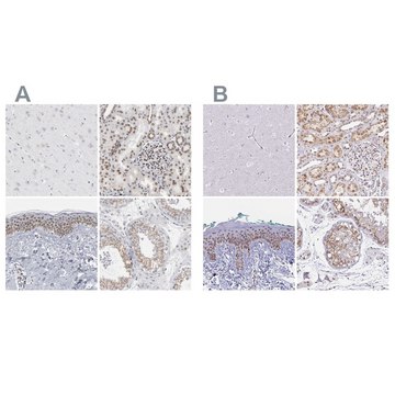 Anti-SYNE2 antibody produced in rabbit Prestige Antibodies&#174; Powered by Atlas Antibodies, affinity isolated antibody, buffered aqueous glycerol solution