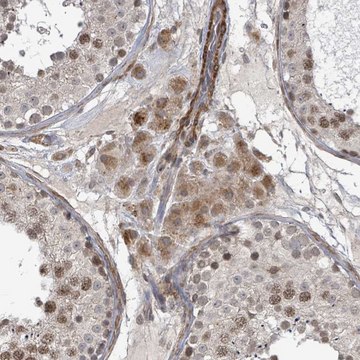 Anti-SBF2 antibody produced in rabbit Prestige Antibodies&#174; Powered by Atlas Antibodies, affinity isolated antibody, buffered aqueous glycerol solution