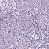 Anti-GABRB2 antibody produced in rabbit Prestige Antibodies&#174; Powered by Atlas Antibodies, affinity isolated antibody, buffered aqueous glycerol solution