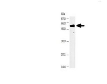 Anti-Beta-glucocerebrosidase (GBA) serum, from mouse