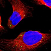 Anti-DCP1A antibody produced in rabbit affinity isolated antibody, buffered aqueous glycerol solution