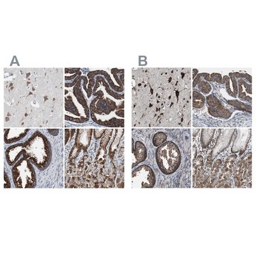 Anti-USP10 antibody produced in rabbit Ab2, Prestige Antibodies&#174; Powered by Atlas Antibodies, affinity isolated antibody, buffered aqueous glycerol solution