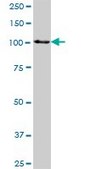 Anti-HSPA4 antibody produced in mouse purified immunoglobulin, buffered aqueous solution