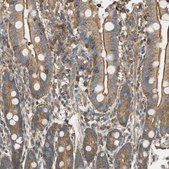 Anti-PI4K2B antibody produced in rabbit Prestige Antibodies&#174; Powered by Atlas Antibodies, affinity isolated antibody, buffered aqueous glycerol solution