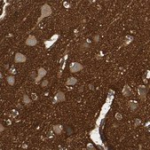 Anti-SPTAN1 antibody produced in rabbit Prestige Antibodies&#174; Powered by Atlas Antibodies, affinity isolated antibody, buffered aqueous glycerol solution
