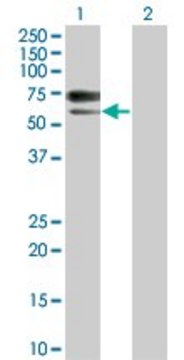 Monoclonal Anti-ACVRL1 antibody produced in mouse clone 7H2, purified immunoglobulin, buffered aqueous solution