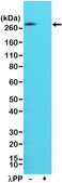 Anti-Phospho Acetyl CoA Carboxylase (Ser79) antibody, Rabbit monoclonal recombinant, expressed in HEK 293 cells, clone RM270, purified immunoglobulin