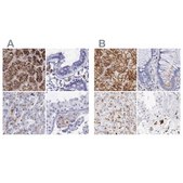 Anti-GLA antibody produced in rabbit Ab2, Prestige Antibodies&#174; Powered by Atlas Antibodies, affinity isolated antibody, buffered aqueous glycerol solution