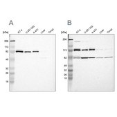 Anti-CARS antibody produced in rabbit Ab1, Prestige Antibodies&#174; Powered by Atlas Antibodies, affinity isolated antibody, buffered aqueous glycerol solution