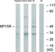 Anti-NPY5R antibody produced in rabbit affinity isolated antibody