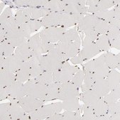 Anti-SIX1 antibody produced in rabbit Prestige Antibodies&#174; Powered by Atlas Antibodies, affinity isolated antibody, buffered aqueous glycerol solution