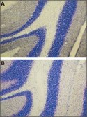 Anti-Endothelin Receptor A antibody produced in rabbit affinity isolated antibody, lyophilized powder