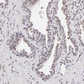 Anti-INTS6 antibody produced in rabbit Prestige Antibodies&#174; Powered by Atlas Antibodies, affinity isolated antibody, buffered aqueous glycerol solution