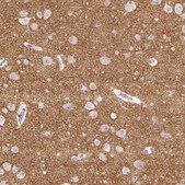 Anti-VGLUT1 antibody produced in rabbit Prestige Antibodies&#174; Powered by Atlas Antibodies, affinity isolated antibody, buffered aqueous glycerol solution