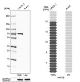 Monoclonal Anti-HNF1B antibody produced in mouse Prestige Antibodies&#174; Powered by Atlas Antibodies, clone CL0374, purified immunoglobulin, buffered aqueous glycerol solution