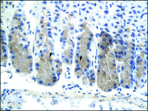 Anti-ELF3 (AB3) antibody produced in rabbit affinity isolated antibody