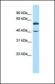 Anti-CYP4V2 antibody produced in rabbit affinity isolated antibody