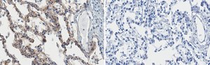 Anti-ITGA3 Antibody, clone 1D6 ZooMAb&#174; Rabbit Monoclonal recombinant, expressed in HEK 293 cells