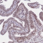 Anti-PCIF1 antibody produced in rabbit Prestige Antibodies&#174; Powered by Atlas Antibodies, affinity isolated antibody, buffered aqueous glycerol solution