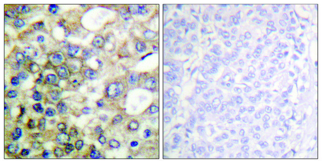 Anti-BTK antibody produced in rabbit affinity isolated antibody