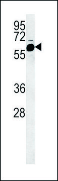 ANTI-FADS2 (CENTER) antibody produced in rabbit IgG fraction of antiserum, buffered aqueous solution