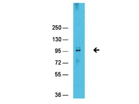 Anti-EZH2 Antibody serum, Upstate&#174;