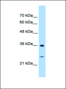 Anti-GSTZ1 antibody produced in rabbit IgG fraction of antiserum