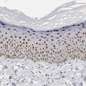 Anti-FOSL2 antibody produced in rabbit Prestige Antibodies&#174; Powered by Atlas Antibodies, affinity isolated antibody, buffered aqueous glycerol solution
