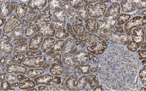 Anti-ULK2 Antibody, clone 3E19 ZooMAb&#174; Rabbit Monoclonal recombinant, expressed in HEK 293 cells